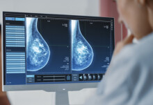 New funding for research investigating how breast cancer resists hormone therapy